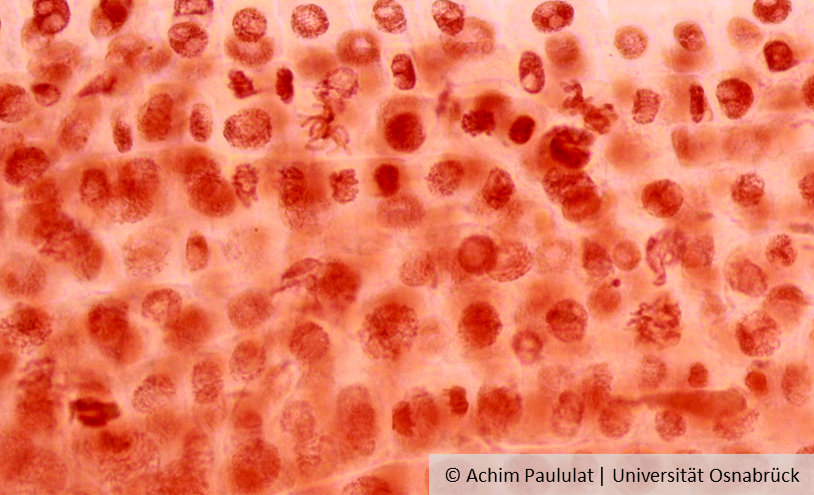 Mikroskopische Aufnahme eines Mitosepräparates, © Achim Paululat