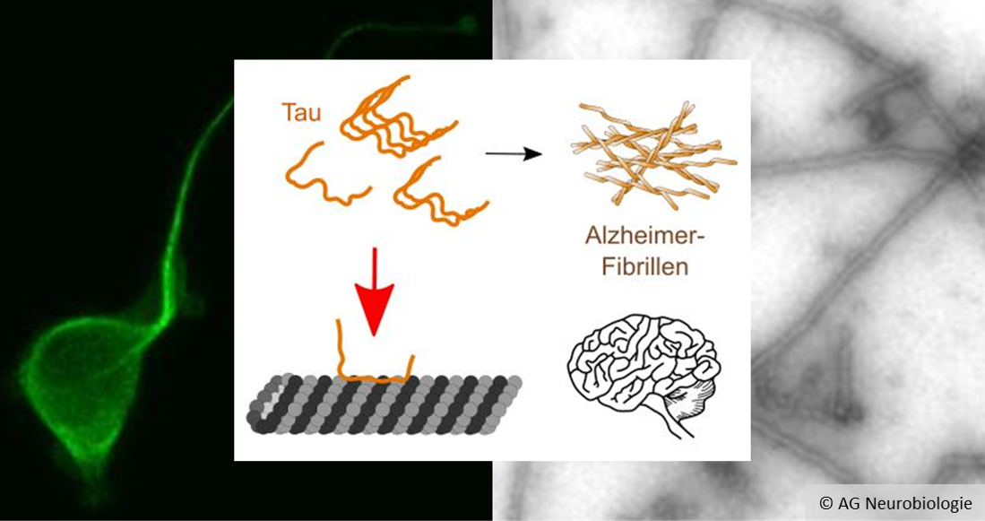 A triple collage; left: A glowing green cell against a black background; centre: a schematic representation of clumping tau proteins; right: a microscopic image shows elongated structures.